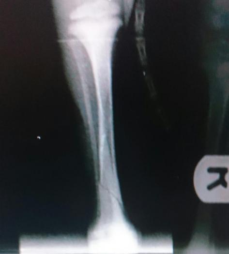 post-94895-0-92346400-1431113061_thumb.jpg
